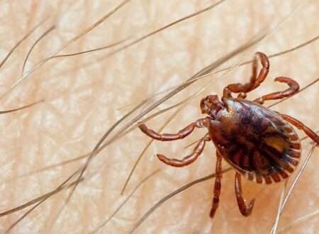 Crimean Congo Hemoorrhagic fever